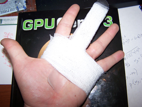 Picture of my broken left middle finger in a splint, in front of a copy of GPU Gems 3 because I'm still a giant nerd